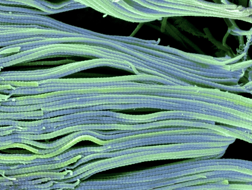 "Collagen. Scanning electron micrograph (SEM) of collagen bundles from the delicate connective tissue ^Iendoneurium^i. Endoneurium wraps around and between individual nerve fibres (axons)